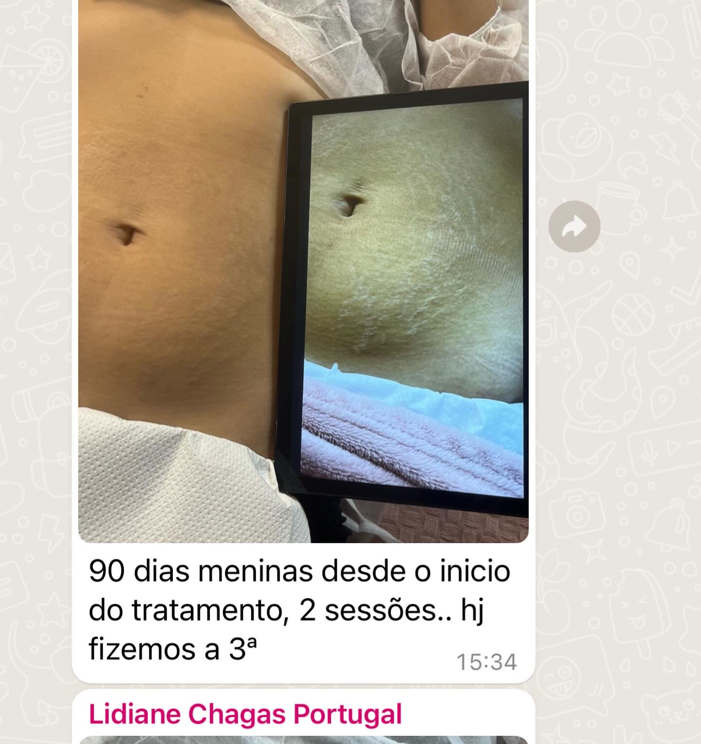 Antes e depois — Método Dermo Strit